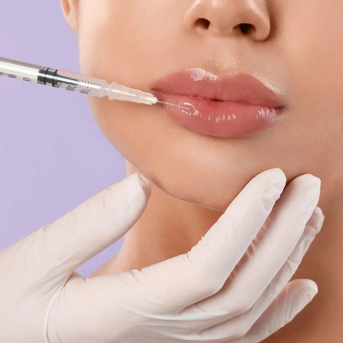 Standard Filler Treatment