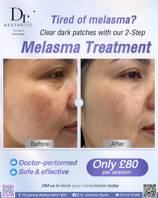 Clear dark patches with 2 step | Melasma Treatment