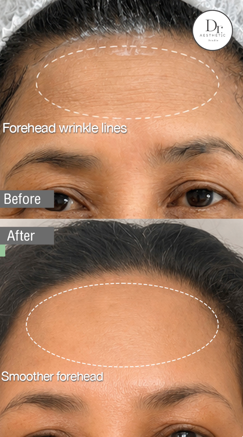 When your skin looks better, you look better.