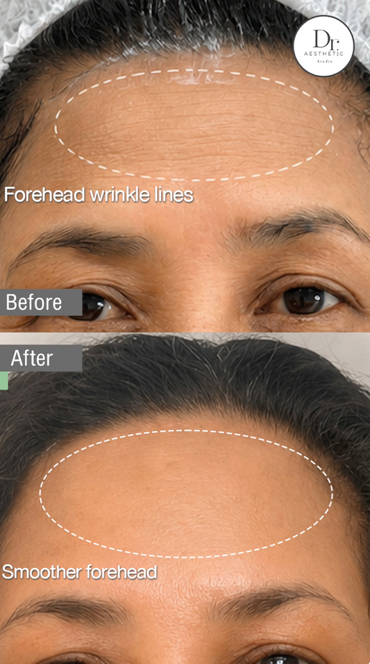 When your skin looks better, you look better.