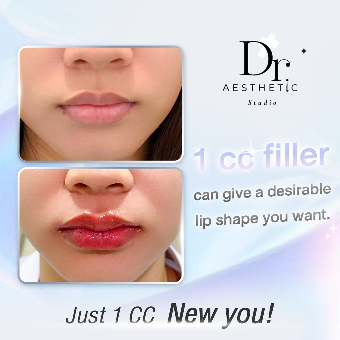 Lip filler review